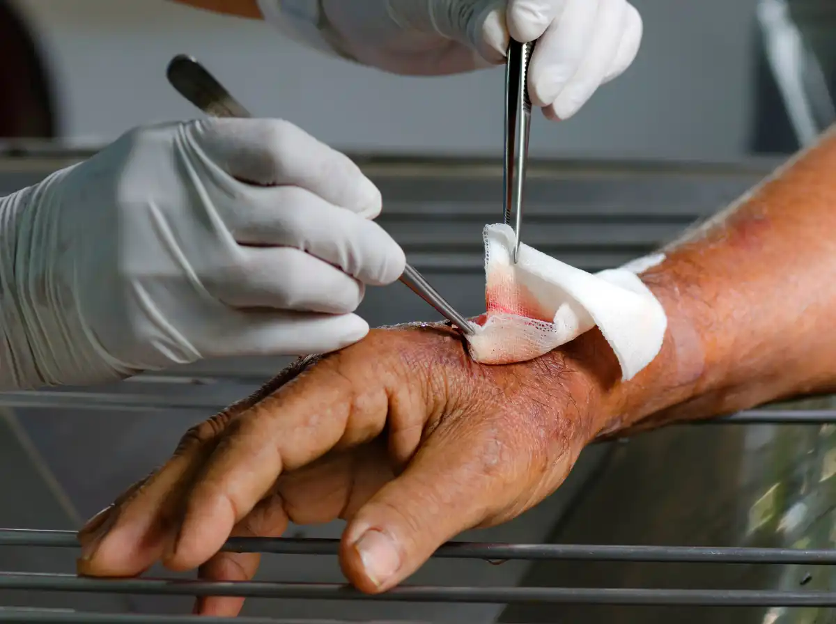Wound Cleaning